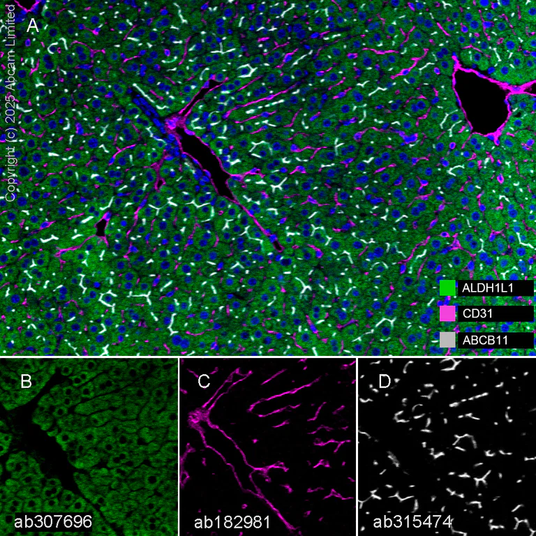Multiplex immunohistochemistry - Anti-ABCB11/BSEP antibody [EPR28773-83] - BSA and Azide free (AB315475)