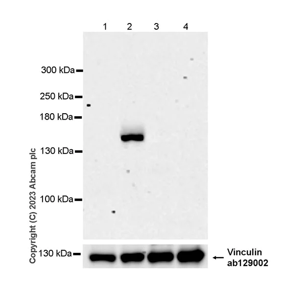 Western blot - Anti-ABCB11/BSEP antibody [EPR28773-83] - BSA and Azide free (AB315475)