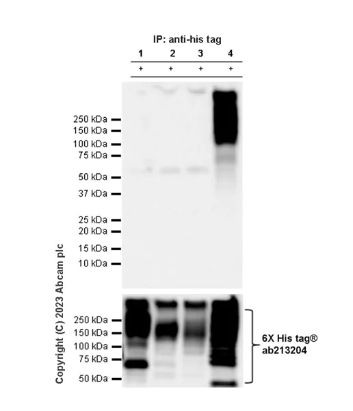 Western blot - Anti-ABCB11/BSEP antibody [EPR28773-83] - BSA and Azide free (AB315475)