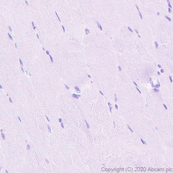 Immunohistochemistry (Formalin/PFA-fixed paraffin-embedded sections) - Anti-ABCB4 antibody [EPR23697-35] (AB272457)