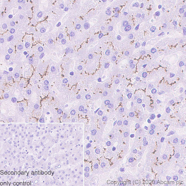 Immunohistochemistry (Formalin/PFA-fixed paraffin-embedded sections) - Anti-ABCB4 antibody [EPR23697-35] (AB272457)