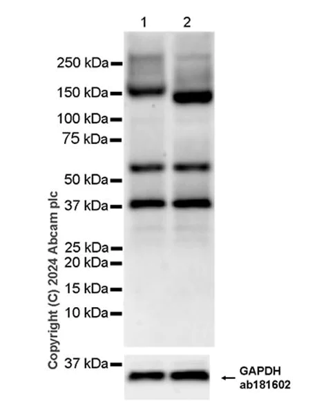 Western blot - Anti-ABCB4 antibody [EPR28774-92] - BSA and Azide free (AB317574)
