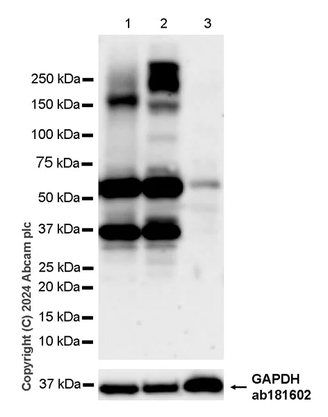 Western blot - Anti-ABCB4 antibody [EPR28774-92] - BSA and Azide free (AB317574)