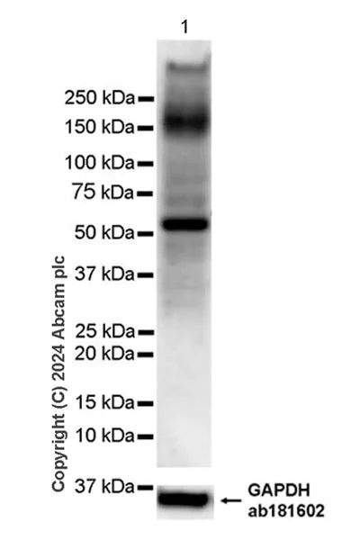 Western blot - Anti-ABCB4 antibody [EPR28774-92] - BSA and Azide free (AB317574)