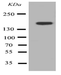 Western blot - Anti-ABCB4 antibody - N-terminal (AB191058)