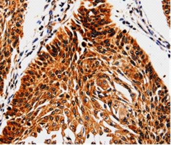 Immunohistochemistry (Formalin/PFA-fixed paraffin-embedded sections) - Anti-ABCB5 antibody (AB197406), expandable thumbnail