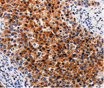 Immunohistochemistry (Formalin/PFA-fixed paraffin-embedded sections) - Anti-ABCB5 antibody (AB197406), expandable thumbnail