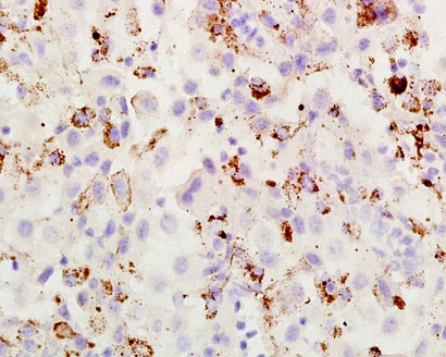 Immunohistochemistry (Formalin/PFA-fixed paraffin-embedded sections) - Anti-ABCB5 antibody (AB203120)