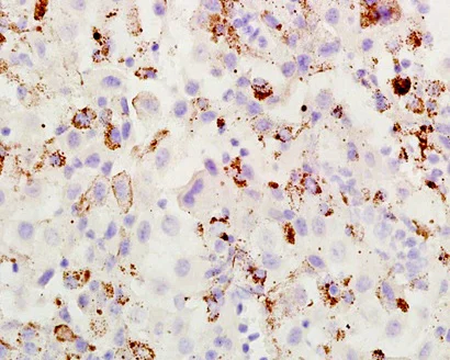 Immunohistochemistry (Formalin/PFA-fixed paraffin-embedded sections) - Anti-ABCB5 antibody (AB203120)