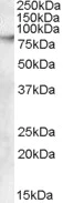 Western blot - Anti-ABCB5 antibody (AB77549)