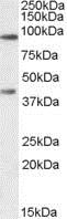 Western blot - Anti-ABCB5 antibody (AB77549)
