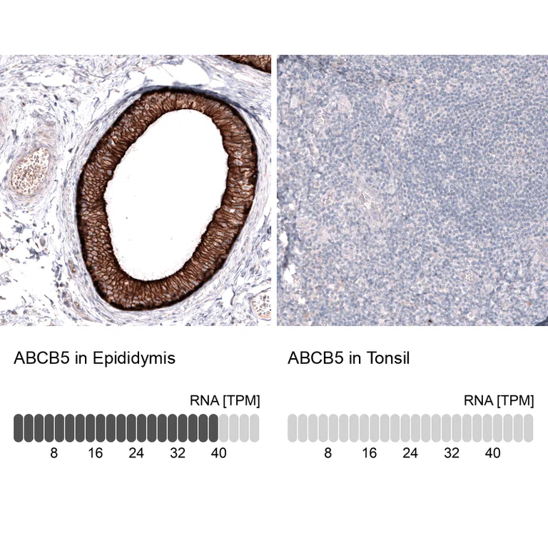 Immunohistochemistry (Formalin/PFA-fixed paraffin-embedded sections) - Anti-ABCB5 Antibody [CL13618] (AB327148)