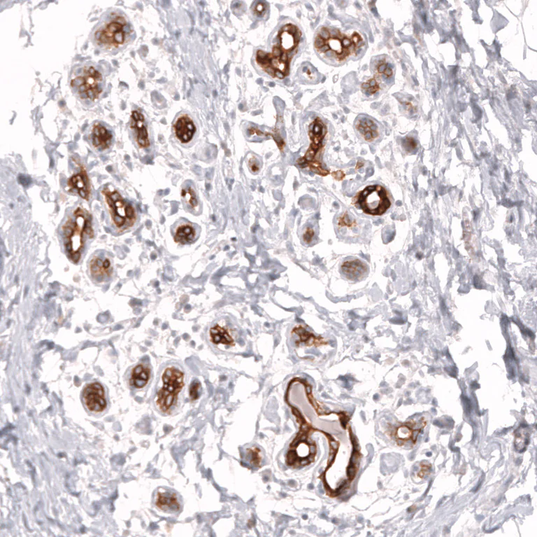 Immunohistochemistry (Formalin/PFA-fixed paraffin-embedded sections) - Anti-ABCB5 Antibody [CL13618] (AB327148)