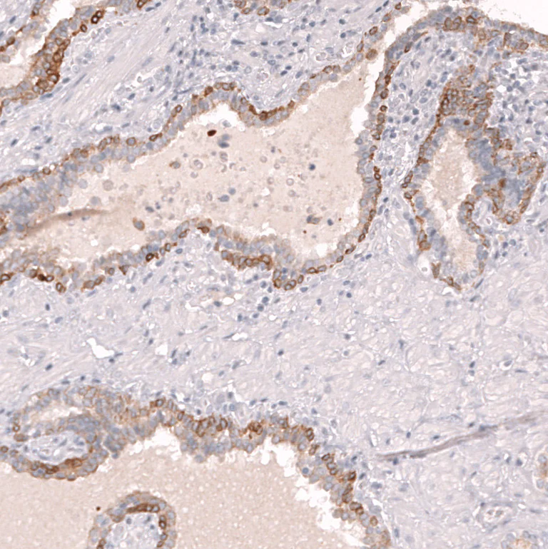 Immunohistochemistry (Formalin/PFA-fixed paraffin-embedded sections) - Anti-ABCB5 Antibody [CL13618] (AB327148)