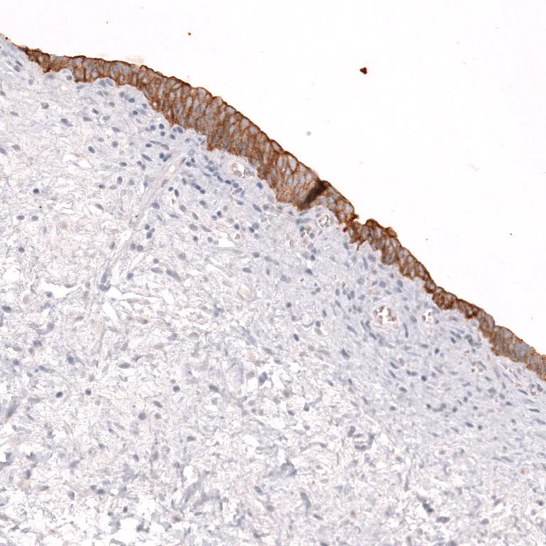 Immunohistochemistry (Formalin/PFA-fixed paraffin-embedded sections) - Anti-ABCB5 Antibody [CL13618] (AB327148)