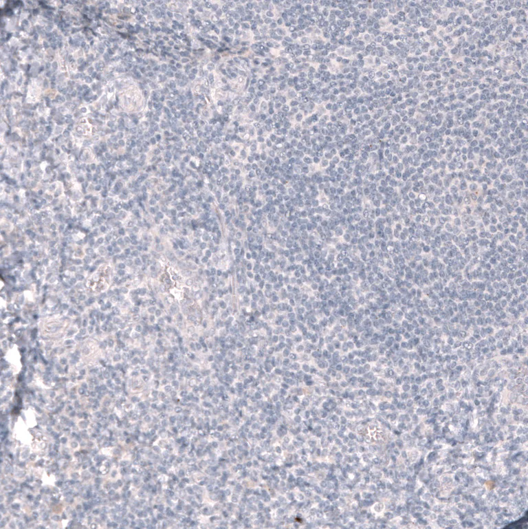 Immunohistochemistry (Formalin/PFA-fixed paraffin-embedded sections) - Anti-ABCB5 Antibody [CL13618] (AB327148)