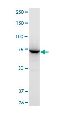 Western blot - Anti-ABCB6/PRP antibody - C-terminal (AB194409), expandable thumbnail