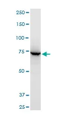 Western blot - Anti-ABCB6/PRP antibody - C-terminal (AB194409)