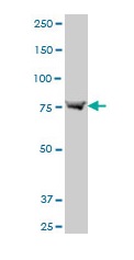 Western blot - Anti-ABCB6/PRP antibody - C-terminal (AB194409), expandable thumbnail