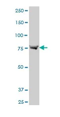 Western blot - Anti-ABCB6/PRP antibody - C-terminal (AB194409)