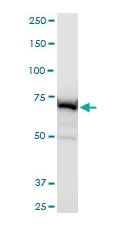 Western blot - Anti-ABCB6/PRP antibody - C-terminal (AB194409)