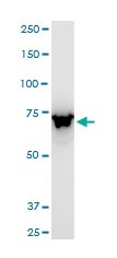 Western blot - Anti-ABCB6/PRP antibody - C-terminal (AB194409), expandable thumbnail