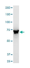 Western blot - Anti-ABCB6/PRP antibody - C-terminal (AB194409)