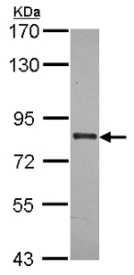 Western blot - Anti-ABCB7 antibody (AB151992), expandable thumbnail