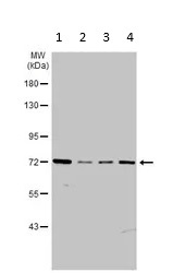 Western blot - Anti-ABCB7 antibody (AB151992)