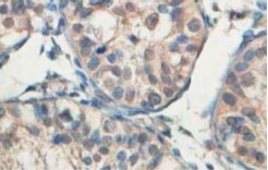 Immunohistochemistry (Formalin/PFA-fixed paraffin-embedded sections) - Anti-ABCB8 antibody (AB104498)