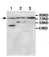 Western blot - Anti-ABCB8 antibody (AB104498)