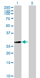 Western blot - Anti-ABCC10 antibody (AB69296)