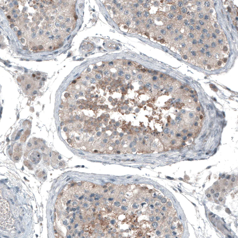 Immunohistochemistry (Formalin/PFA-fixed paraffin-embedded sections) - Anti-ABCC11 antibody (AB272609)