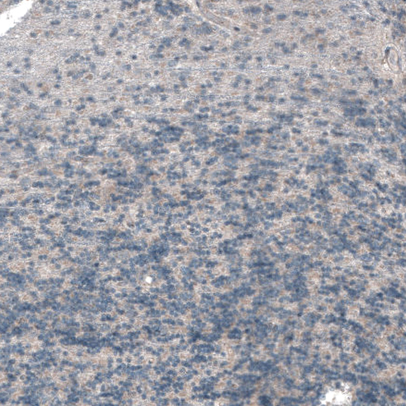 Immunohistochemistry (Formalin/PFA-fixed paraffin-embedded sections) - Anti-ABCC11 antibody (AB272609), expandable thumbnail