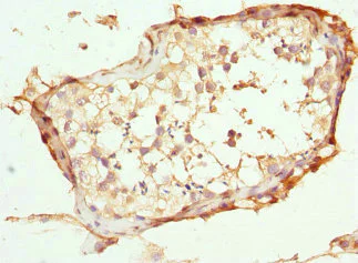 Immunohistochemistry (Formalin/PFA-fixed paraffin-embedded sections) - Anti-ABCC11 antibody - N-terminal (AB229741)
