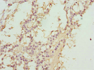 Immunohistochemistry (Formalin/PFA-fixed paraffin-embedded sections) - Anti-ABCC11 antibody - N-terminal (AB229741), expandable thumbnail