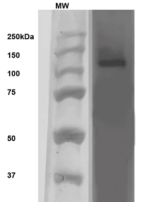 Western blot - Anti-ABCC9 antibody [N319A/14] - C-terminal (AB174629)