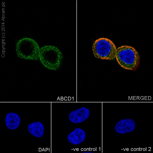 Immunocytochemistry/ Immunofluorescence - Anti-ABCD1/ALD antibody [EPR15929] (AB197013)