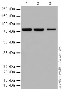 Anti-ABCD1/ALD antibody [EPR15929]