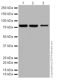 Western blot - Anti-ABCD1/ALD antibody [EPR15929] (AB197013)