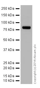 Western blot - Anti-ABCD1/ALD antibody [EPR15929] (AB197013)
