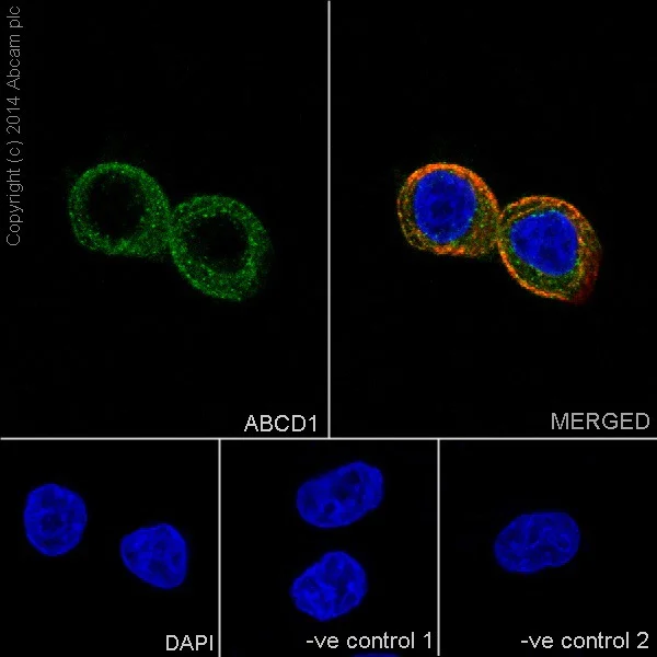 Immunocytochemistry/ Immunofluorescence - Anti-ABCD1/ALD antibody [EPR15929] - BSA and Azide free (AB238989)