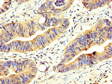 Immunohistochemistry (Formalin/PFA-fixed paraffin-embedded sections) - Anti-ABCD2 antibody (AB238502)