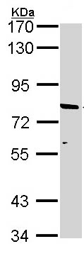 Western blot - Anti-ABCD2 antibody (AB97383), expandable thumbnail