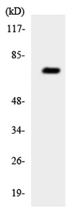 Western blot - Anti-ABCD4 antibody (AB135480), expandable thumbnail