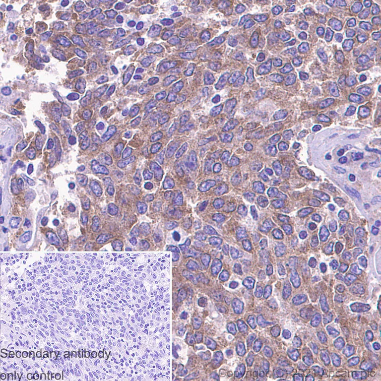 Immunohistochemistry (Formalin/PFA-fixed paraffin-embedded sections) - Anti-ABCE1 antibody [EPR15373(B)] - BSA and Azide free (AB250835)