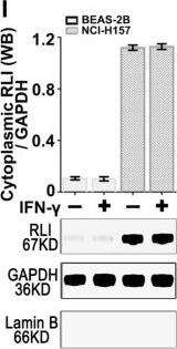 Western blot - Anti-ABCE1 antibody [EPR15373(B)] - C-terminal (ab185548), expandable thumbnail
