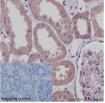 Immunohistochemistry (Formalin/PFA-fixed paraffin-embedded sections) - Anti-ABCF1 antibody [EPR16068] - BSA and Azide free (AB251040)