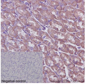 Immunohistochemistry (Formalin/PFA-fixed paraffin-embedded sections) - Anti-ABCF1 antibody [EPR16068] - C-terminal (AB190798)