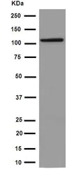 Western blot - Anti-ABCF1 antibody [EPR16068] - C-terminal (AB190798)